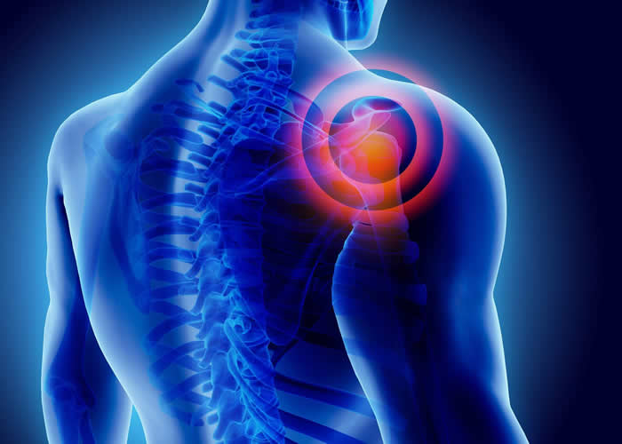 3 Critical Reasons Why You Need to Fix Your Clients' Posture 3 Critical Reasons Why You Need to Fix Your Clients' Posture